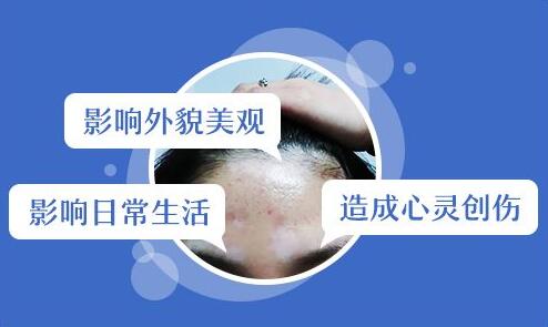 得了白癜风就不能生孩子？白癜风到底有哪些危害